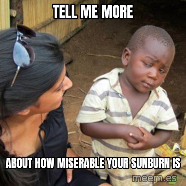 Skeptical 3rd World Kid meme: Tell me more / about how miserable your sunburn is