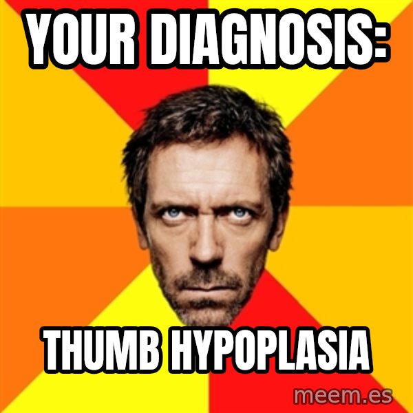 Diagnostic House meme: Your Diagnosis: / Thumb hypoplasia